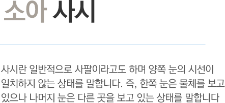 소아 사시 - 사시란 일반적으로 사팔이라고도 하며 양쪽 눈의 시선이 일치하지 않는 상태를 말합니다. 즉, 한쪽 눈은 물체를 보고 있으나 나머지 눈은 다른 곳으 보고 있는 상태를 마합니다