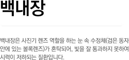 백내장 - 백내장은 사진기 렌즈 역할을 하는 눈 속 수정체(검은 동자 안에 있는 볼록렌즈)가 혼탁되어, 빛을 잘 통과하지 못하여 시력이 저하되는 질환입니다.